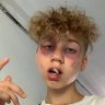 imgonnadie